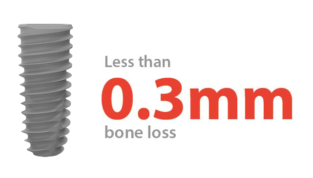 Dentium Implant Less than 0.3mm Bone Loss